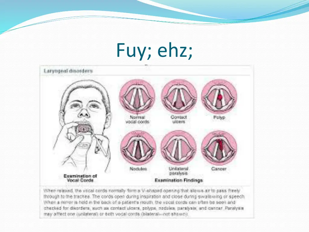 fuy ehz