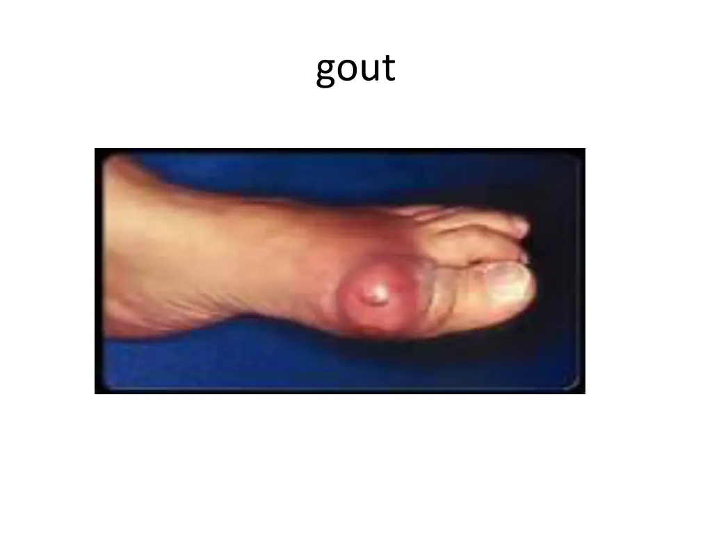 slide23