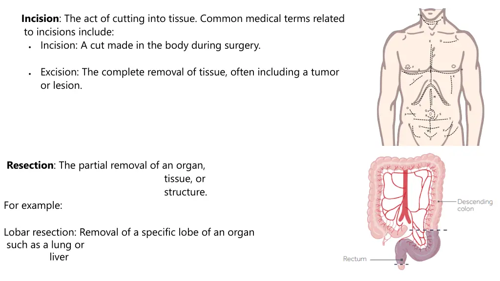 incision the act of cutting into tissue common