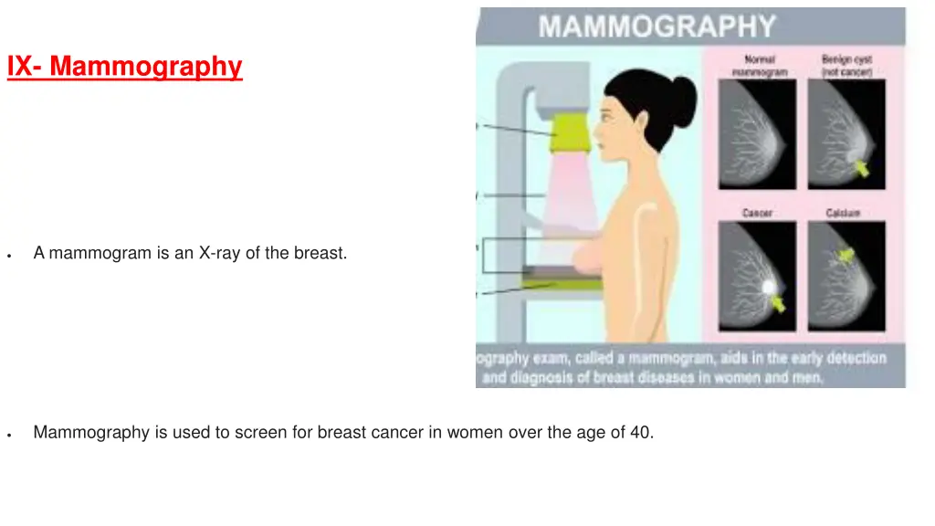 ix mammography