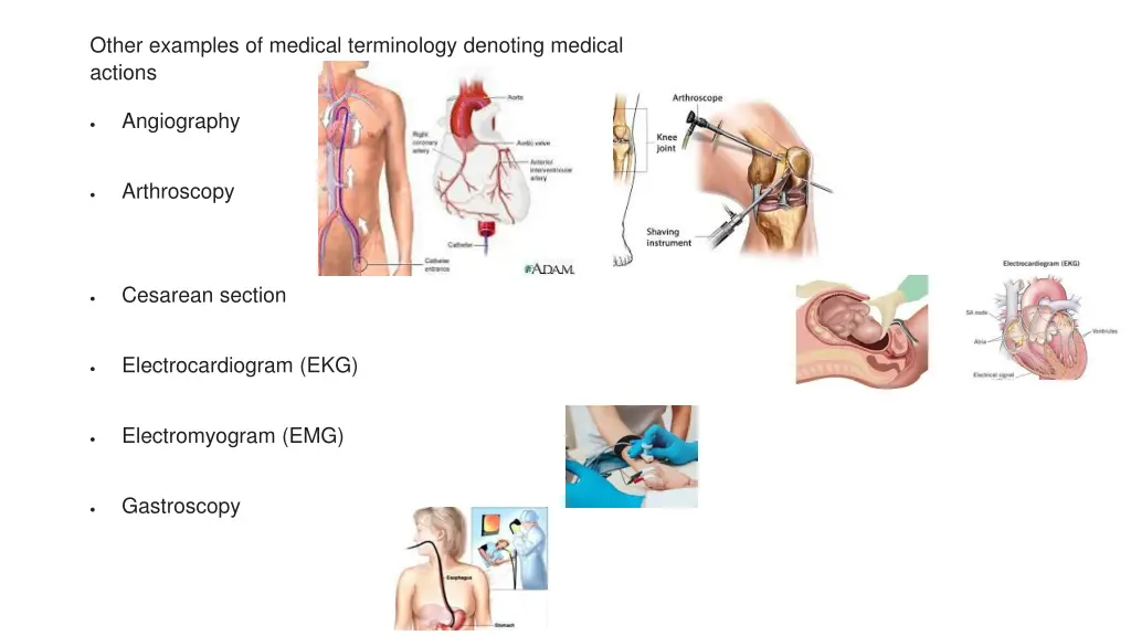 other examples of medical terminology denoting