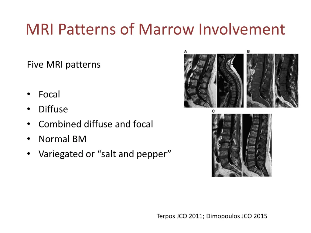 mri patterns of marrow involvement