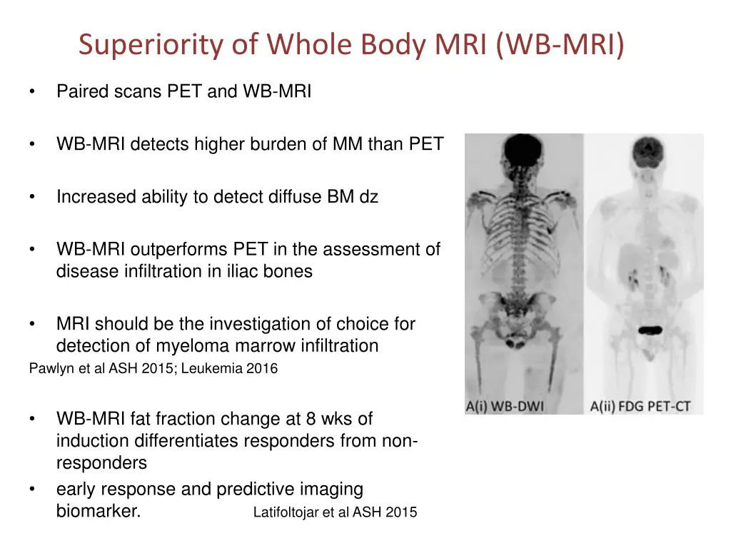 superiority of whole body mri wb mri