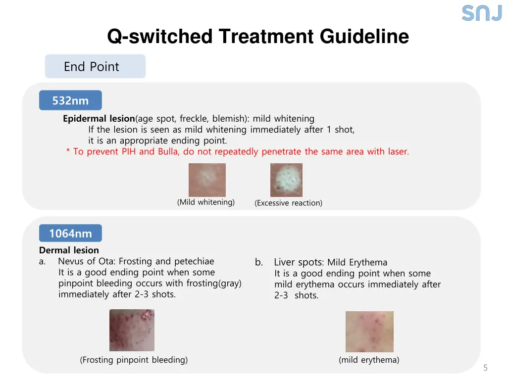 q switched treatment guideline 3