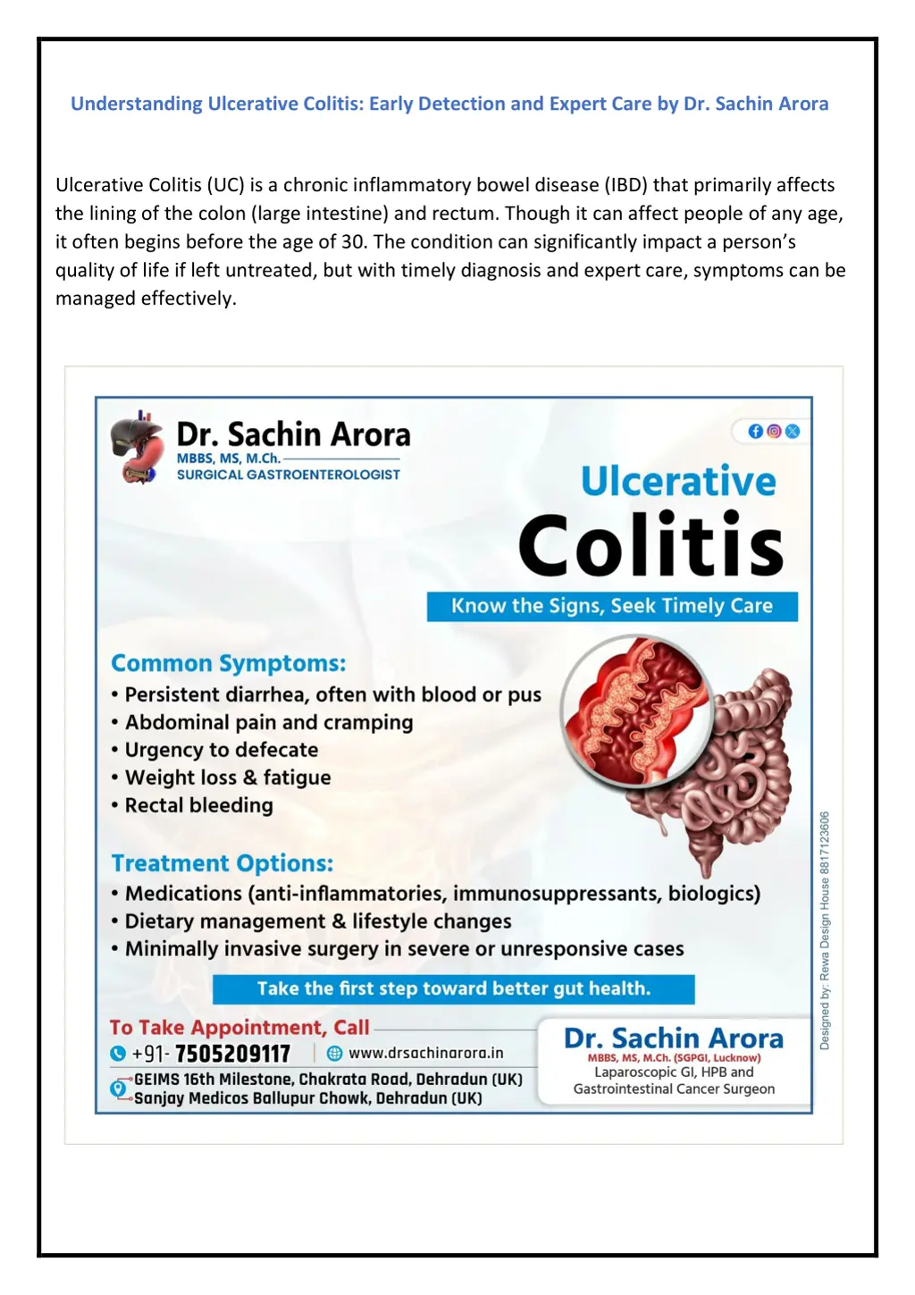 understanding ulcerative colitis early detection