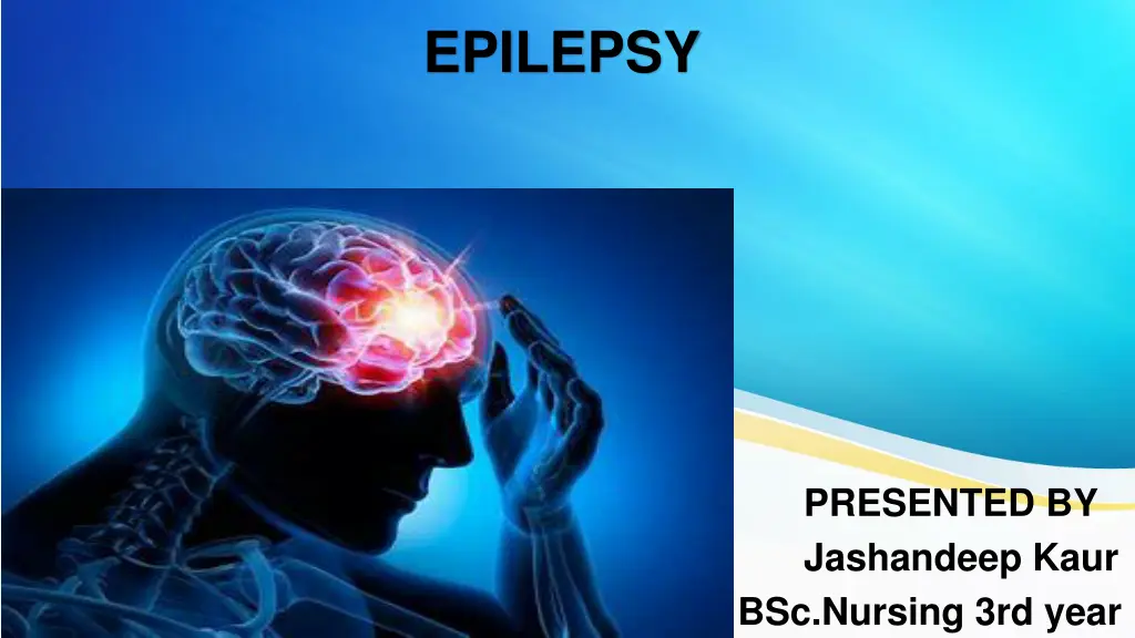 epilepsy