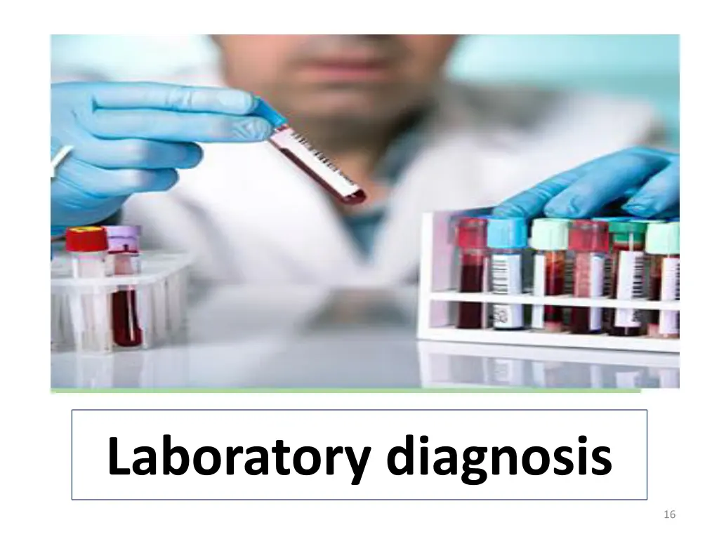 laboratory diagnosis