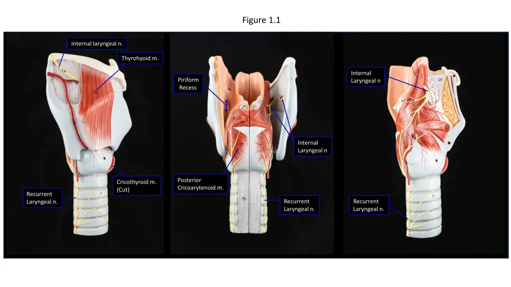 figure 1 1