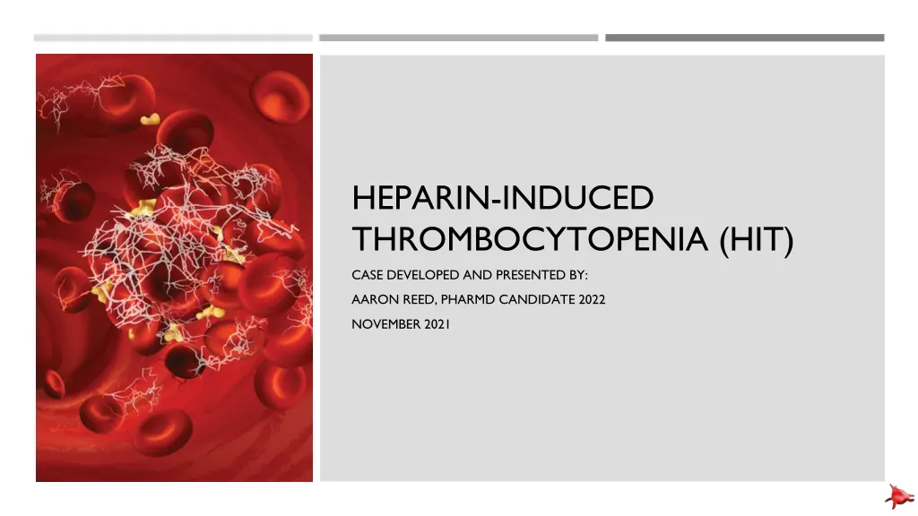 heparin induced thrombocytopenia hit case