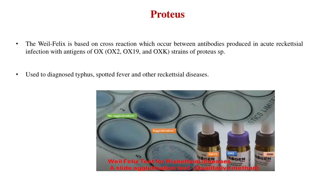 proteus 4