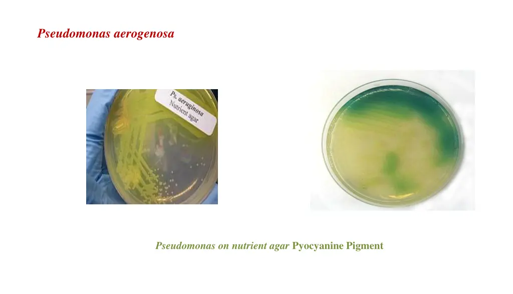 pseudomonas aerogenosa