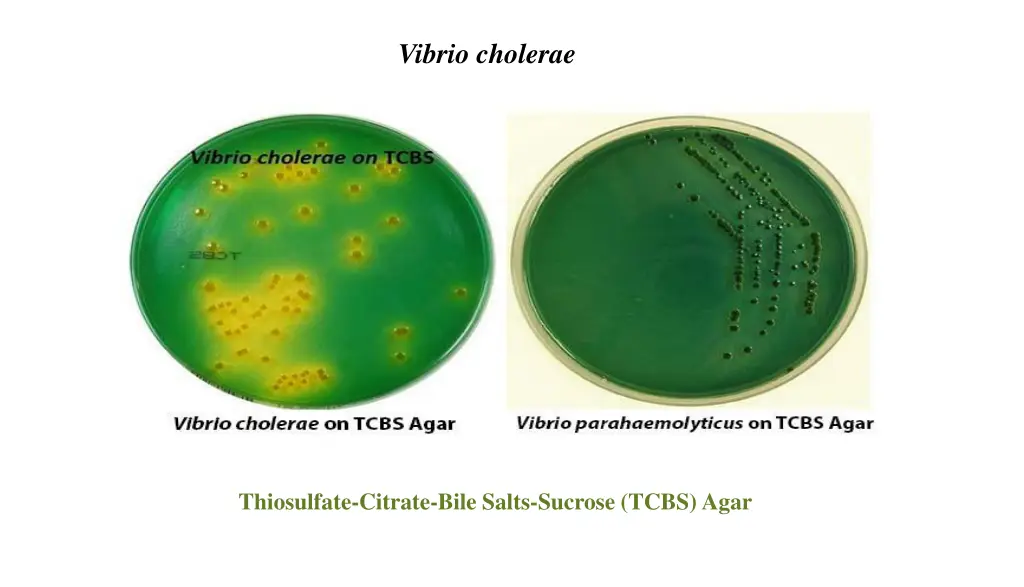 vibrio cholerae 4