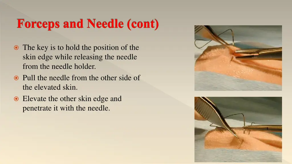forceps and needle cont