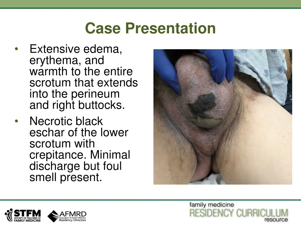 case presentation extensive edema erythema