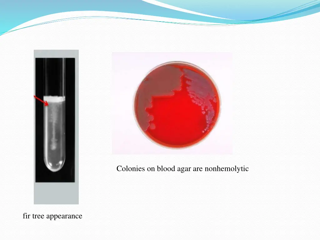 colonies on blood agar are nonhemolytic
