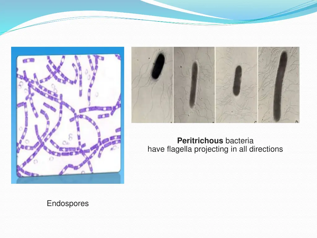 peritrichous bacteria have flagella projecting