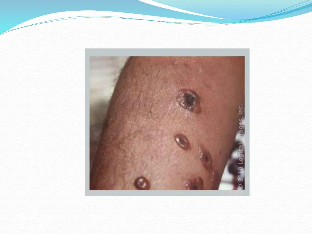 slide10