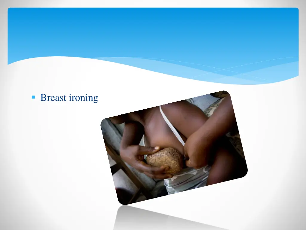 breast ironing
