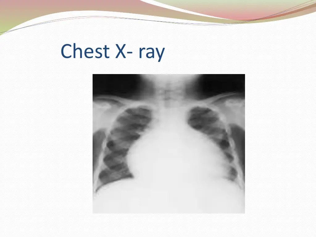 chest x ray