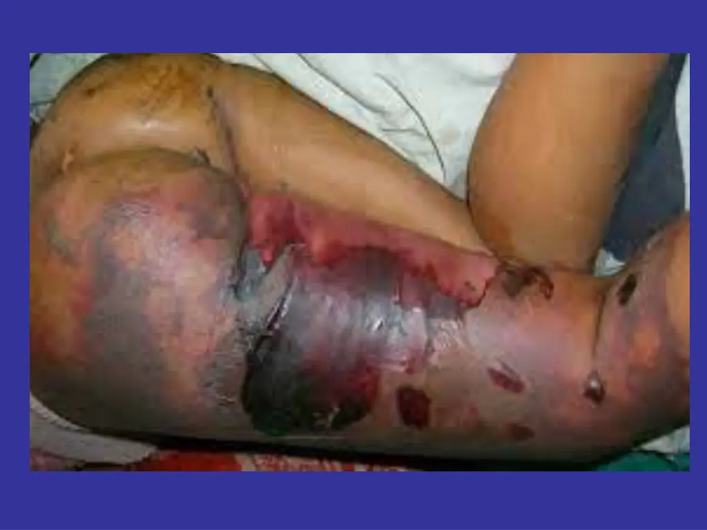 slide24