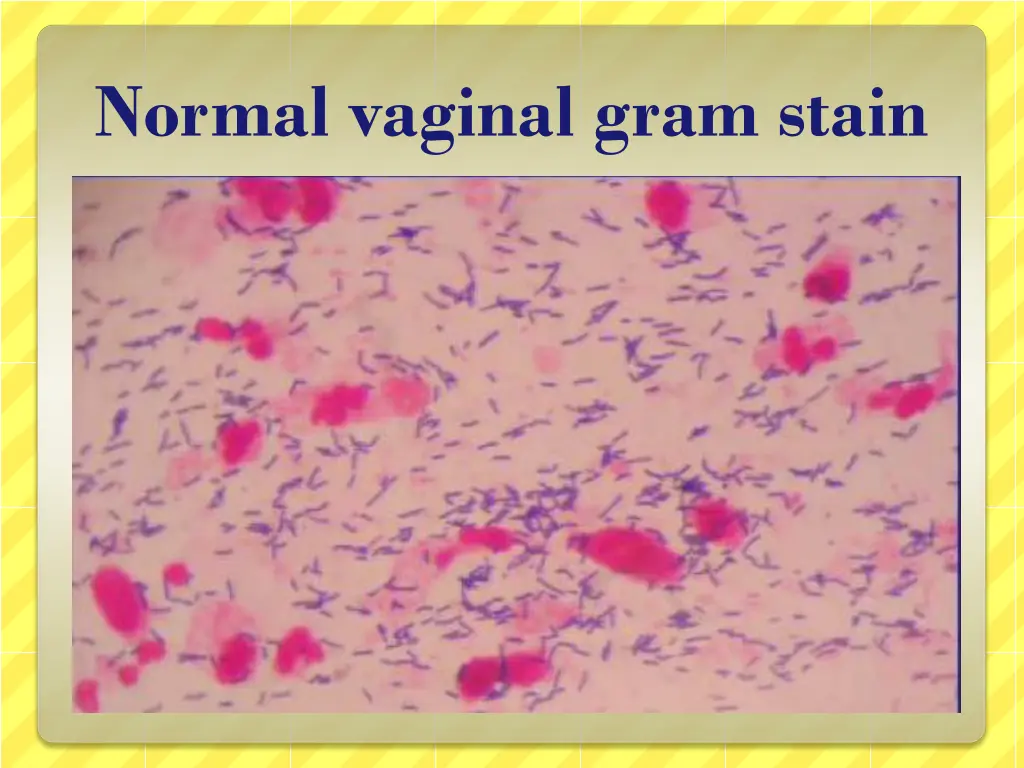 normal vaginal gram stain