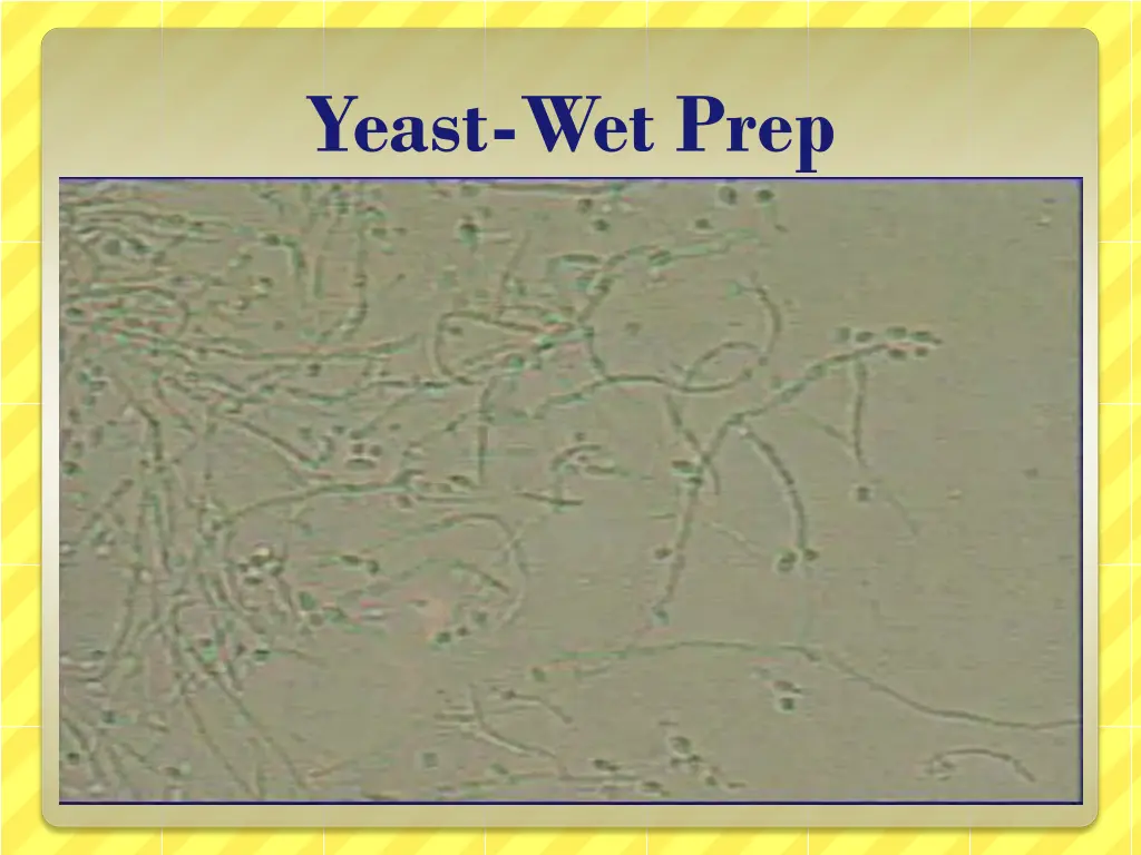yeast wet prep