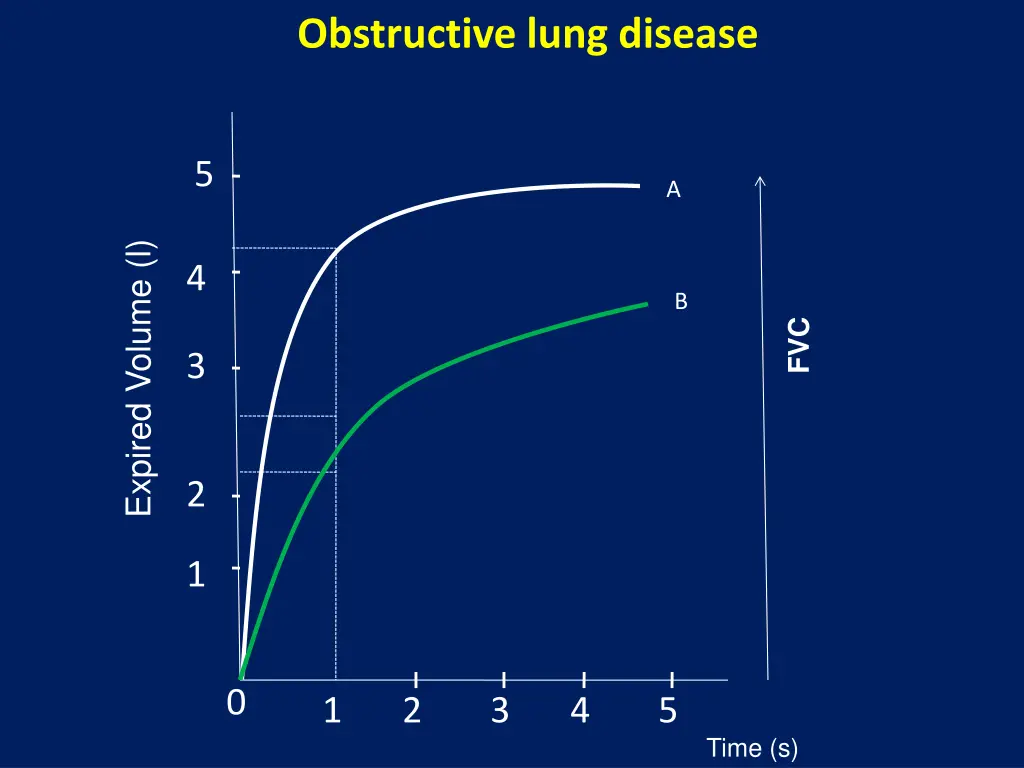 obstructive lung disease