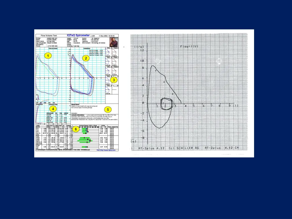 slide24