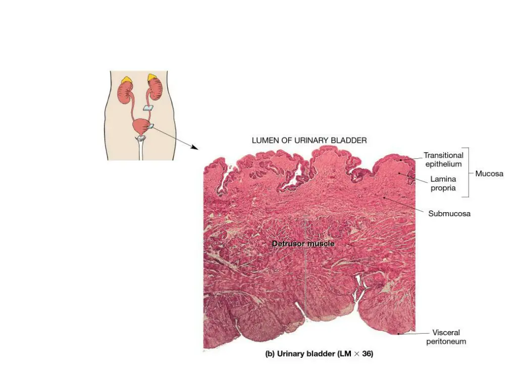 slide25
