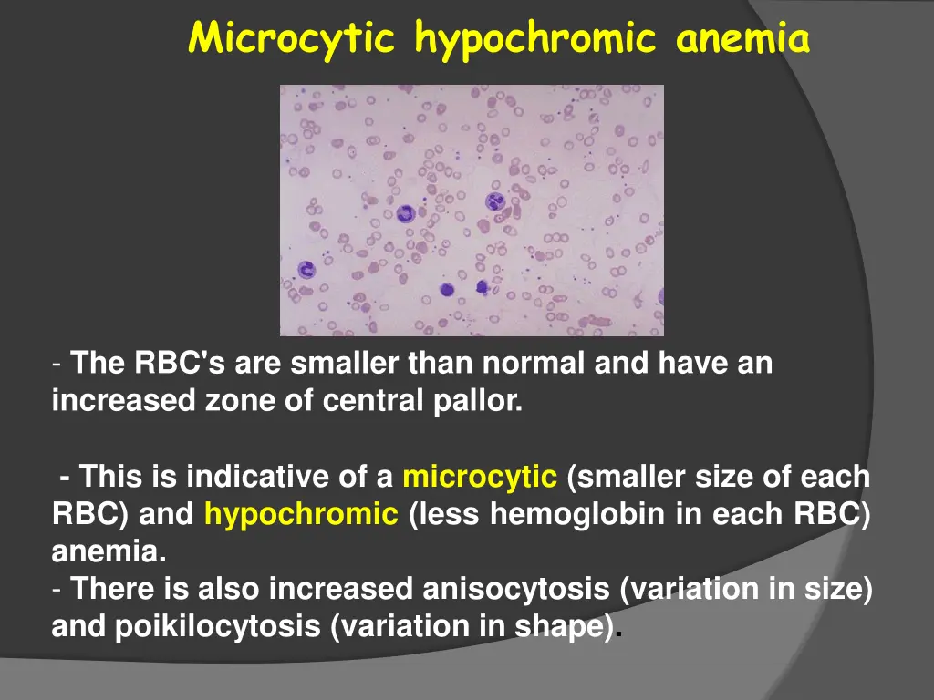 microcytic hypochromic anemia