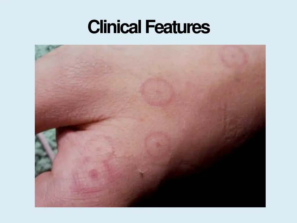 clinicalfeatures 1