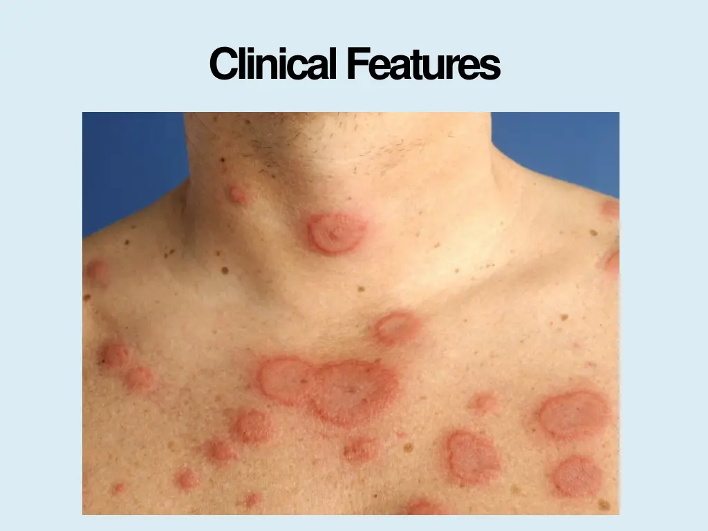 clinicalfeatures 3