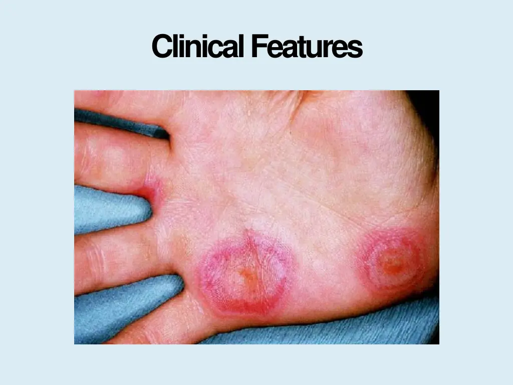 clinicalfeatures 4