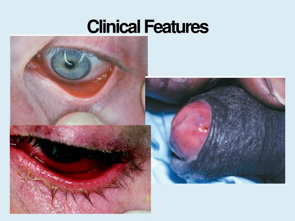 clinicalfeatures 6