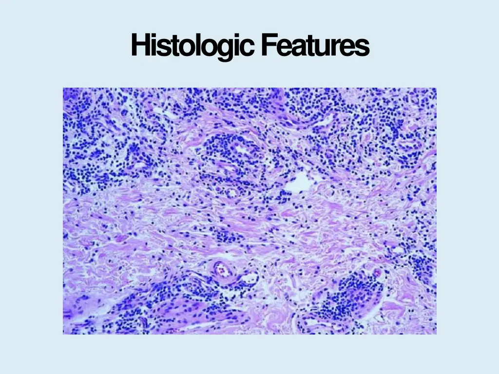 histologicfeatures 3