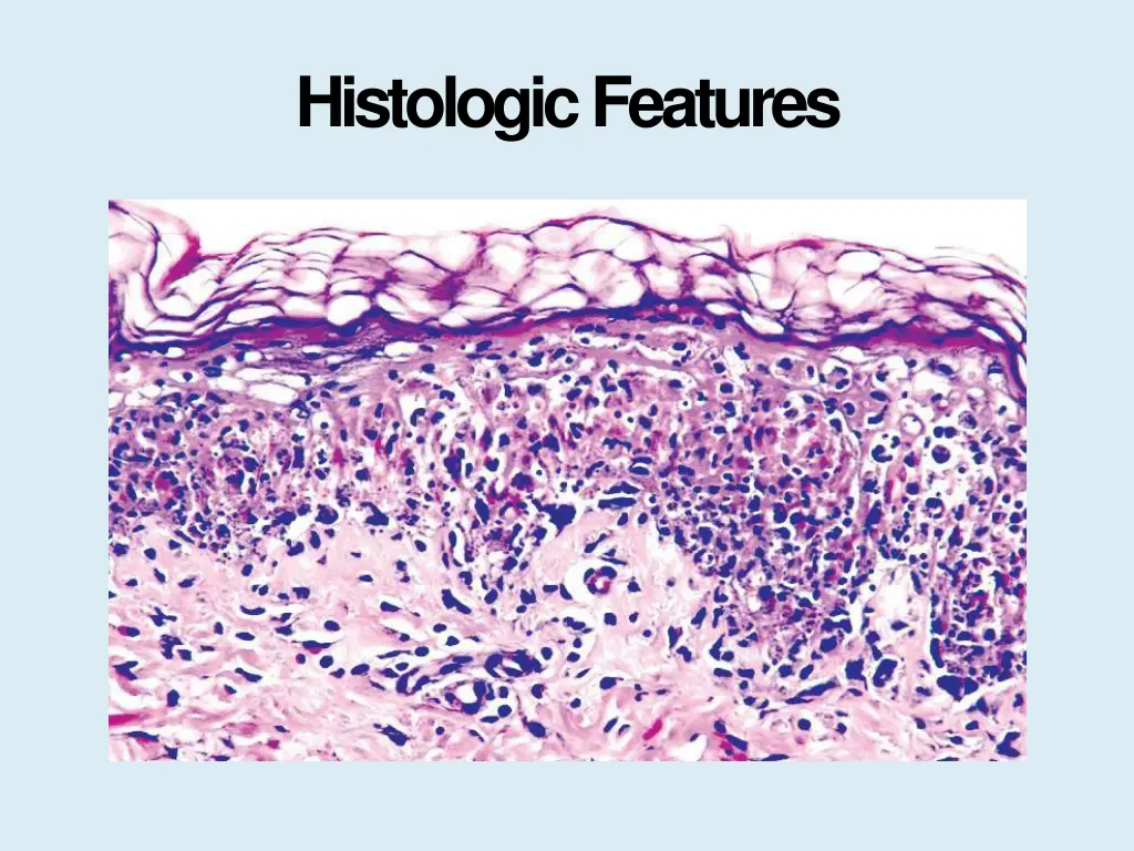 histologicfeatures 4