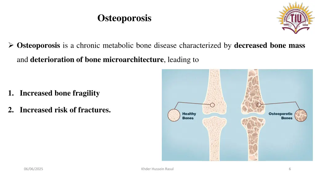 osteoporosis