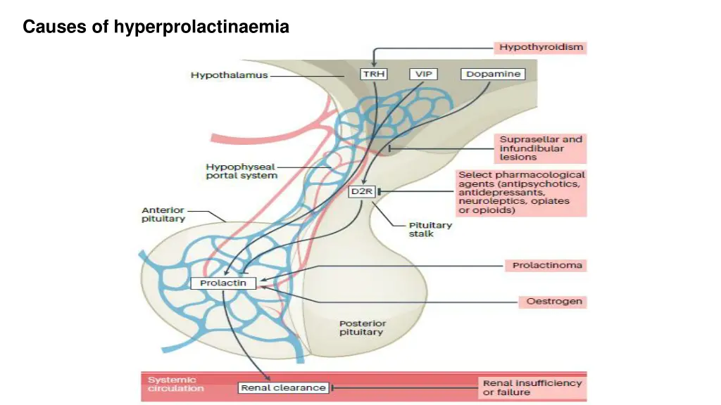 causes of hyperprolactinaemia