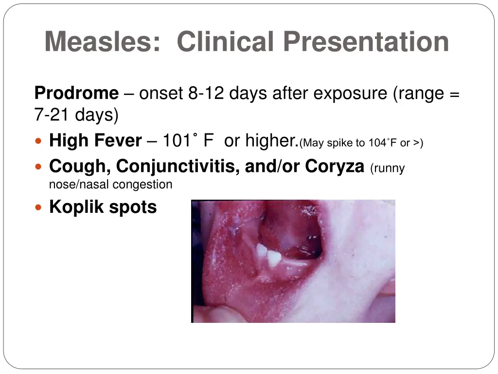 measles clinical presentation