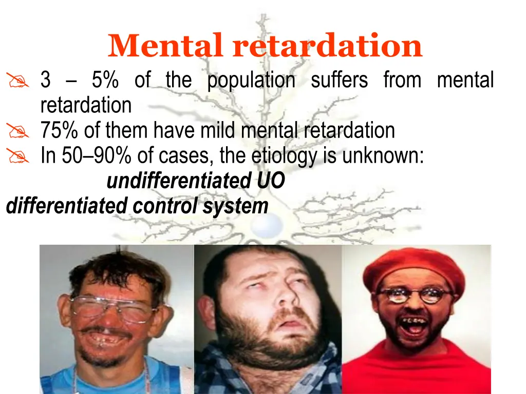 mental retardation 3 5 of the population suffers