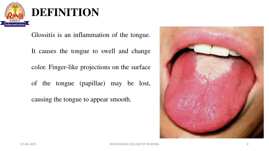 definition