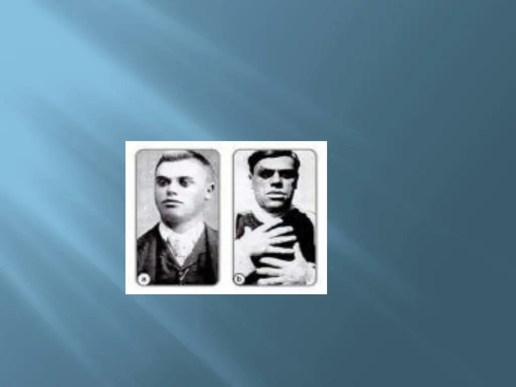 slide16