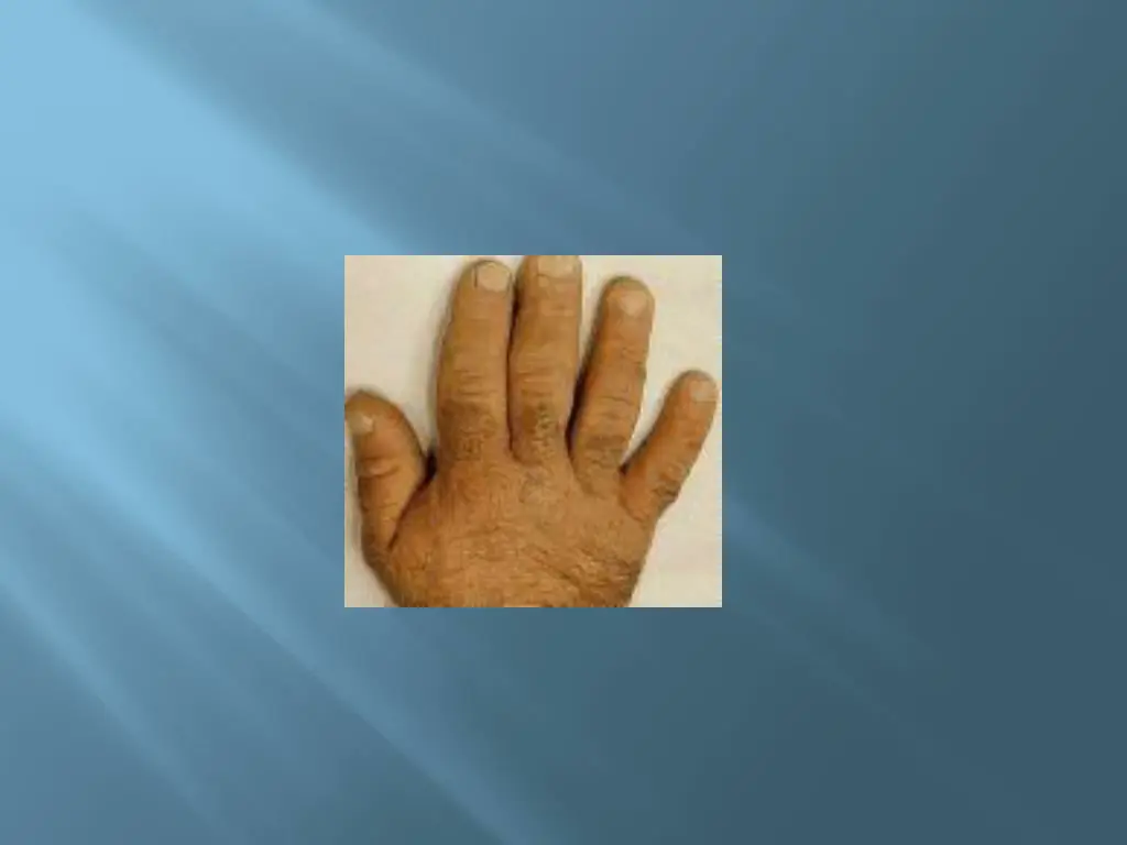 slide19