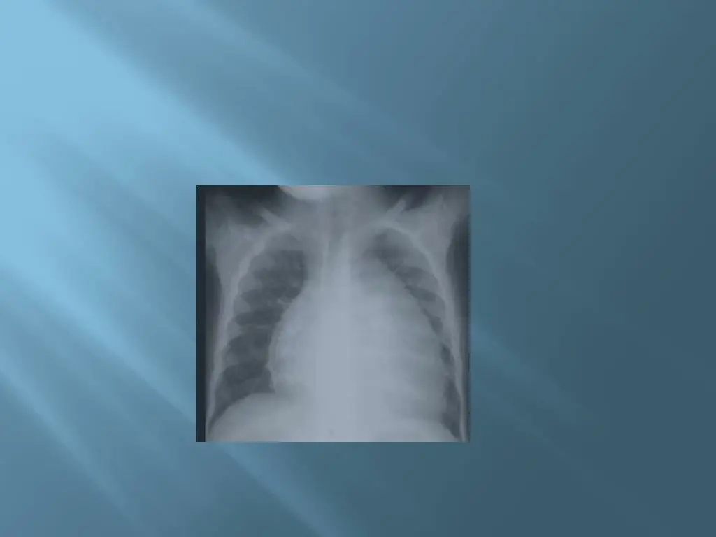 slide22
