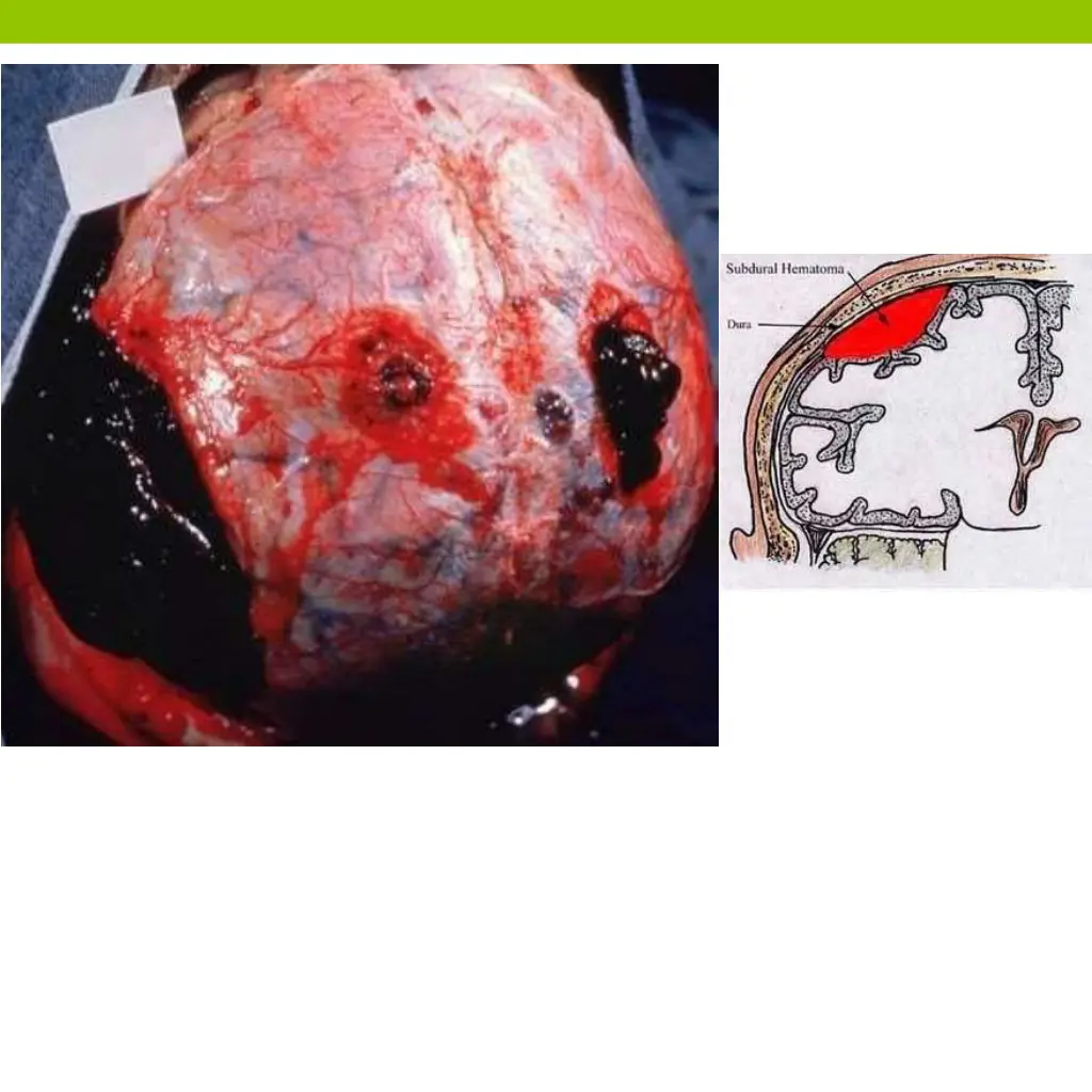 slide26