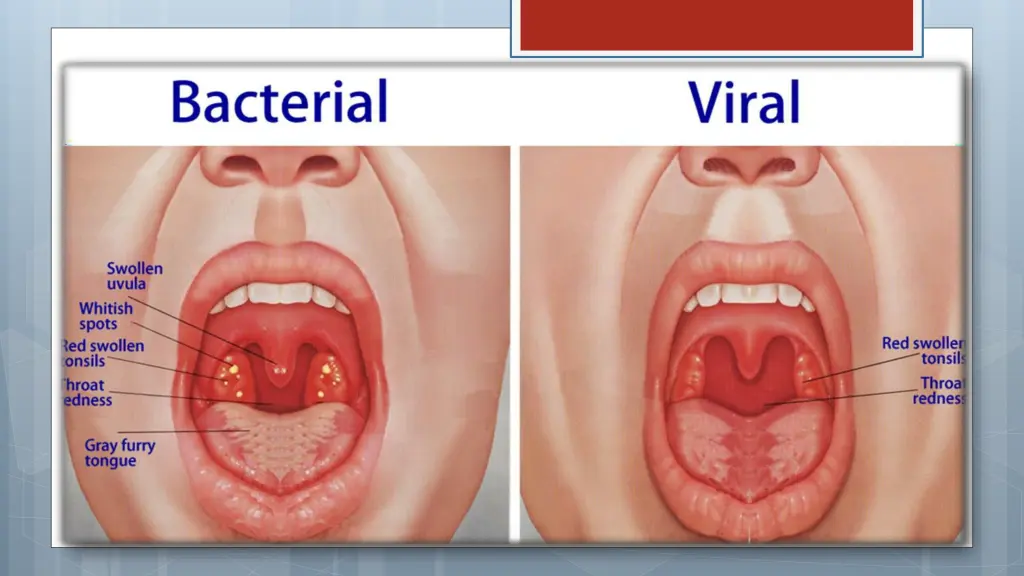 slide17