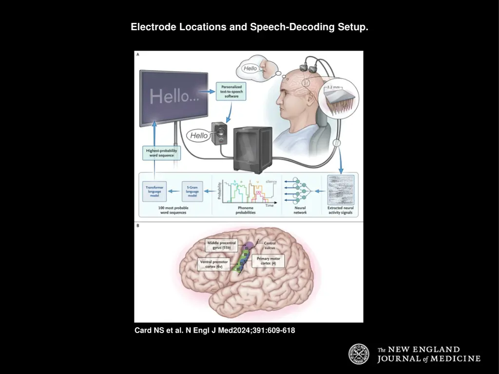 electrode locations and speech decoding setup