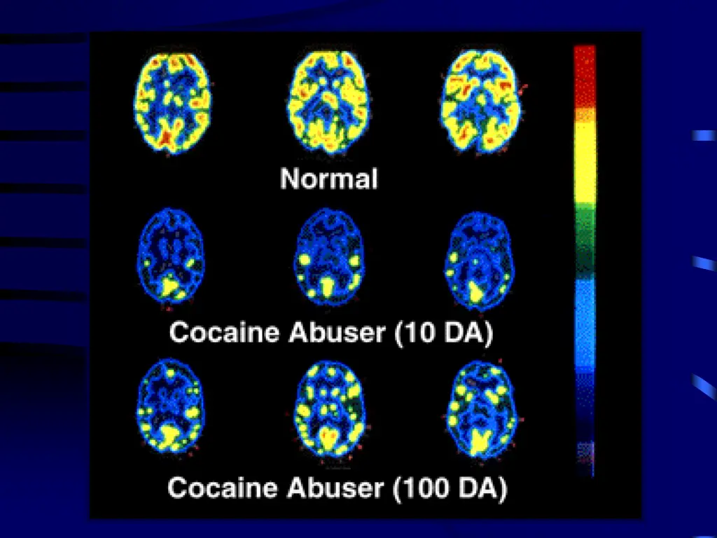 slide37
