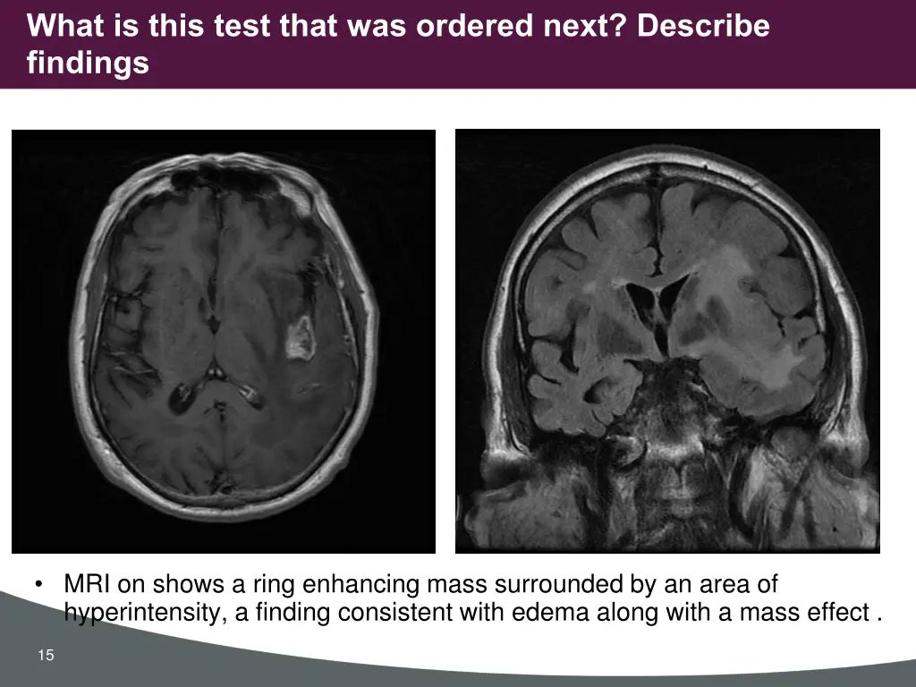 what is this test that was ordered next describe 1
