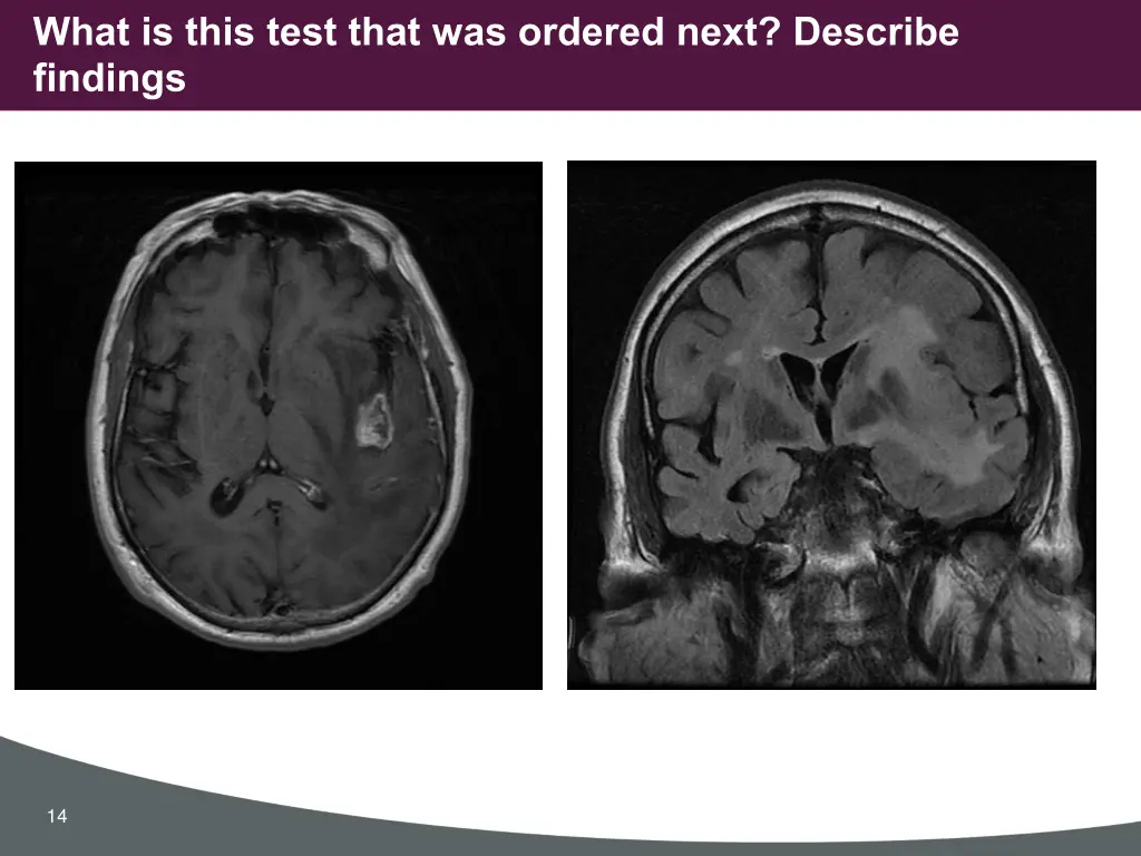what is this test that was ordered next describe